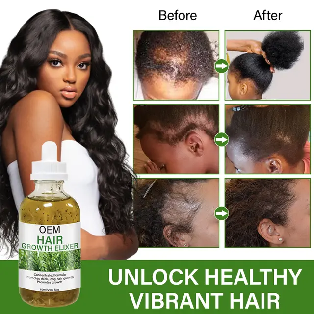 Hair growth oil